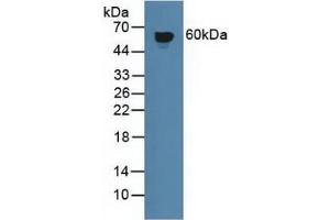 Figure. (IFNGR1 antibody  (AA 18-245))