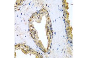 Immunohistochemistry of paraffin-embedded human prostate using TNFSF10 antibody at dilution of 1:200 (40x lens). (TRAIL antibody)