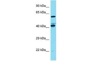 Western Blotting (WB) image for anti-KIAA1841 (KIAA1841) (C-Term) antibody (ABIN2791620)