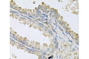Immunohistochemistry of paraffin-embedded Human prostate using PPIC Polyclonal Antibody at dilution of 1:100 (40x lens). (PPIC antibody)
