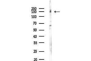 Western blot analysis of lysates from Hela cells(LPS 4h treatment), using Phospho-EGFR (Ser1071) Antibody at 1/1000 dilution.