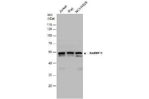 WB Image hnRNP H antibody detects hnRNP H protein by western blot analysis.