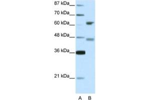 Western Blotting (WB) image for anti-Regulatory Factor X 4 (RFX4) antibody (ABIN2460674) (RFX4 antibody)