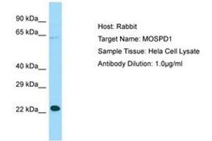 Image no. 1 for anti-Motile Sperm Domain Containing 1 (MOSPD1) (N-Term) antibody (ABIN6750115) (MOSPD1 antibody  (N-Term))