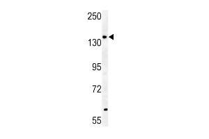 ABCB4- (ABIN390060 and ABIN2840588) western blot analysis in mouse heart tissue lysates (35 μg/lane). (ABCB4 antibody  (AA 624-654))