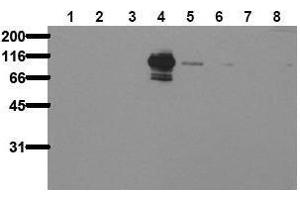 Western Blotting (WB) image for anti-PTK2B Protein tyrosine Kinase 2 beta (PTK2B) (pTyr402) antibody (ABIN126880) (PTK2B antibody  (pTyr402))