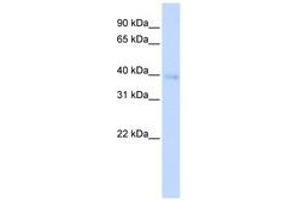 Image no. 1 for anti-Homeobox A11 (HOXA11) (AA 144-193) antibody (ABIN6741430) (Homeobox A11 antibody  (AA 144-193))