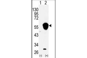 Image no. 1 for anti-Aldehyde Dehydrogenase 3 Family, Member A1 (ALDH3A1) (N-Term) antibody (ABIN360202) (ALDH3A1 antibody  (N-Term))