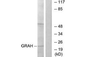Western Blotting (WB) image for anti-Granzyme H (Cathepsin G-Like 2, Protein H-CCPX) (GZMH) (AA 51-100) antibody (ABIN6766432) (GZMH antibody  (AA 51-100))