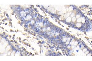 Detection of vWA2 in Human Colon Tissue using Polyclonal Antibody to Von Willebrand Factor A Domain Containing Protein 2 (vWA2) (VWA2 antibody  (AA 457-708))