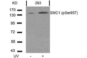 Western blot analysis of extracts from 293 cells untreated or treated with UV using SMC1(Phospho-Ser957) Antibody. (SMC1A antibody  (pSer957))