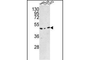 Western blot analysis of C9orf156 Antibody (C-term) (ABIN390925 and ABIN2841127) in Hela, CEM, T47D cell line lysates (35 μg/lane).