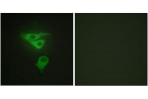Immunofluorescence analysis of HepG2 cells, using PDLIM1 Antibody. (PDLIM1 antibody  (AA 61-110))