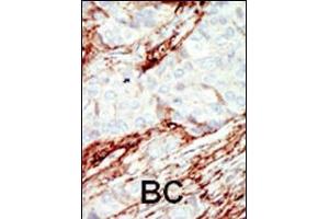 Immunohistochemistry (Paraffin-embedded Sections) (IHC (p)) image for anti-Fibroblast Growth Factor Receptor 1 (FGFR1) (AA 19-48), (N-Term) antibody (ABIN1882081)