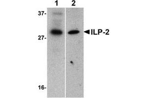 Western blot analysis of ILP-2 expression in human HepG2 (lane 1) and MOLT4 (lane 2) cell lysates with AP30430PU-N ILP-2 antibody at 1 μg/ml. (ILP-2 antibody)