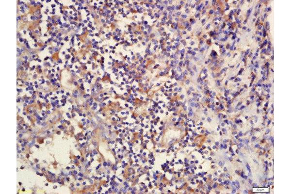 DcR2 antibody