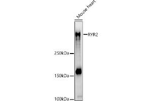 Western blot analysis of extracts of Mouse heart, using RYR2 antibody (ABIN1513493, ABIN3020906, ABIN3020907 and ABIN6213787) at 1:710 dilution.