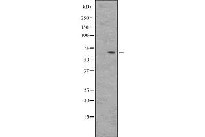 Western blot analysis of BIN2 expression in HepG2 whole cell lysate ,The lane on the left is treated with the antigen-specific peptide. (BIN2 antibody  (Internal Region))