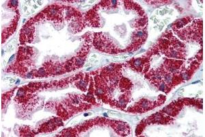 Human Kidney (formalin-fixed, paraffin-embedded) stained with BAX antibody ABIN337236 at 10 ug/ml followed by biotinylated anti-mouse IgG secondary antibody ABIN481714, alkaline phosphatase-streptavidin and chromogen. (BAX antibody)