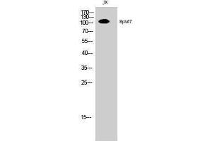 Western Blotting (WB) image for anti-EPH Receptor A7 (EPHA7) (Ser347) antibody (ABIN3178054) (EPH Receptor A7 antibody  (Ser347))