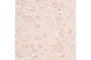 Immunohistochemistry of paraffin-embedded mouse brain using CDH18 antibody (ABIN6291131) at dilution of 1:100 (40x lens).