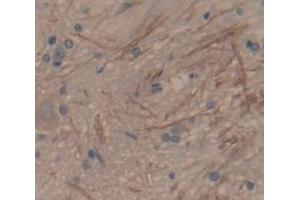IHC-P analysis of Rat Tissue, with DAB staining. (SFRP1 antibody  (AA 8-153))