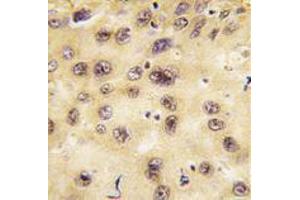 Image no. 3 for anti-Prospero Homeobox 1 (PROX1) (Center) antibody (ABIN357418) (PROX1 antibody  (Center))