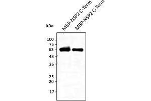 Western Blotting (WB) image for anti-SARS-CoV-2 Non-Structural Protein 2 (NSP2) (C-Term) antibody (ABIN7272997) (SARS-CoV-2 NSP2 antibody  (C-Term))
