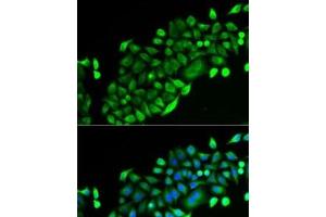 Immunofluorescence analysis of U2OS cells using GSTO2 Polyclonal Antibody (GSTO2 antibody)