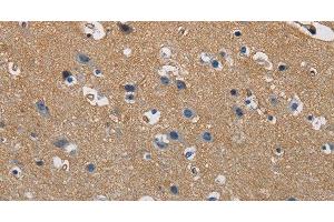 Immunohistochemistry of paraffin-embedded Human brain tissue using GSTA2 Polyclonal Antibody at dilution 1:50 (GSTa2 antibody)
