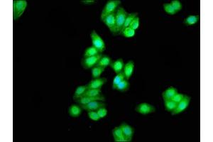 Immunofluorescence staining of HepG2 cells with ABIN7146858 at 1:333, counter-stained with DAPI. (Casein Kinase 1 delta antibody  (Isoform delta))