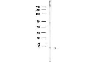 anti-Golgi Transport 1B (GOLT1B) antibody