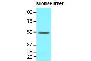 Western Blotting (WB) image for anti-Epoxide Hydrolase 1, Microsomal (Xenobiotic) (EPHX1) (AA 21-455) antibody (ABIN371868) (EPHX1 antibody  (AA 21-455))