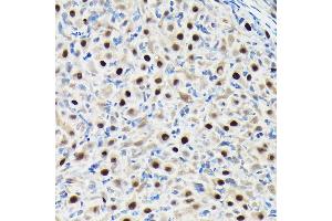 Immunohistochemistry of paraffin-embedded rat ovary using GTPBP4 Rabbit pAb (ABIN1680142, ABIN3019054, ABIN3019055 and ABIN6220689) at dilution of 1:50 (40x lens). (GTPBP4 antibody  (AA 385-634))
