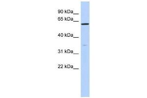ZNF431 antibody used at 0. (ZNF431 antibody  (N-Term))