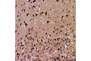 Immunohistochemical analysis of NFAT5 staining in human brain formalin fixed paraffin embedded tissue section. (NFAT5 antibody  (N-Term))