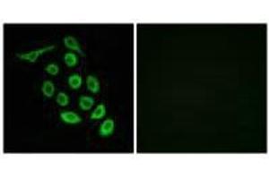 Immunofluorescence analysis of A549 cells, using RPS12 antibody. (RPS12 antibody  (C-Term))