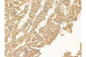 ABIN6258617 and ABIN6274962 at 1/100 staining rat heart tissue by IHC-P.
