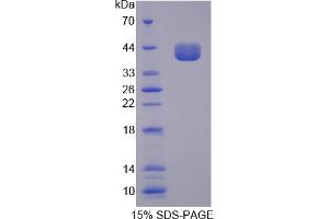 Image no. 1 for CD14 (CD14) (AA 21-373) protein (His tag) (ABIN4988494) (CD14 Protein (CD14) (AA 21-373) (His tag))