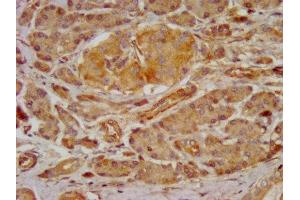 GRPR antibody  (AA 326-384)