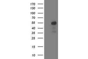 Western Blotting (WB) image for anti-Aminoacylase 1 (ACY1) antibody (ABIN1496453) (Aminoacylase 1 antibody)