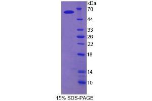 Image no. 1 for Tyrosyl-DNA Phosphodiesterase 1 (TDP1) (AA 1-271) protein (His tag,GST tag) (ABIN6239614) (TDP1 Protein (AA 1-271) (His tag,GST tag))