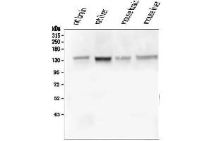 Western blot analysis of GM130 using anti-GM130 antibody (ABIN6719433). (Golgin A2 (GOLGA2) (AA 796-913) antibody)
