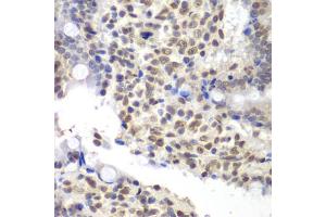 Immunohistochemistry of paraffin-embedded rat Intestine using U2AF1 antibody (ABIN5970409) at dilution of 1/200 (40x lens). (U2AF1 antibody)
