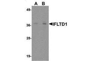 Western blot analysis of IFLTD1 in rat liver tissue lysate with IFLTD1 antibody at (A) 1 and (B) 2 ug/mL. (PAS1C1 antibody  (Middle Region))