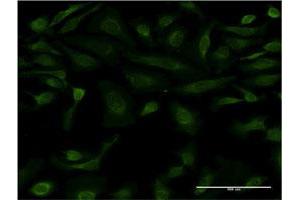 Immunofluorescence of monoclonal antibody to IL15 on HeLa cell. (IL-15 antibody  (AA 49-162))