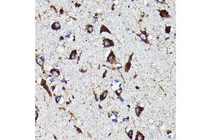 Immunohistochemistry of paraffin-embedded human brain using Cathepsin D antibody (ABIN7266149) at dilution of 1:100 (40x lens). (Cathepsin D antibody)