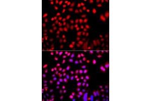 Immunofluorescence analysis of A549 cells using CFL2 antibody. (Cofilin 2 antibody  (AA 1-166))
