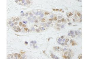 anti-Partner and Localizer of BRCA2 (PALB2) (AA 200-250) antibody
