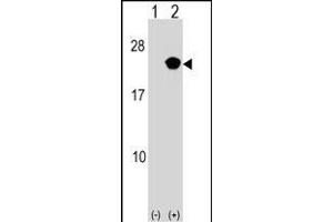 Western blot analysis of RB (arrow) using rabbit polyclonal RB Antibody (Center) (ABIN1537716 and ABIN2849042). (RAP2B antibody  (AA 102-129))